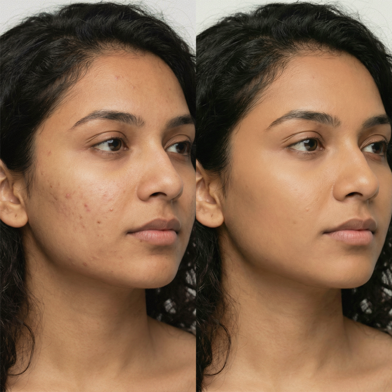 AMAZINGCONCEALER - Full Coverage Waterproof Concealer for Dark Circles & Blemishes