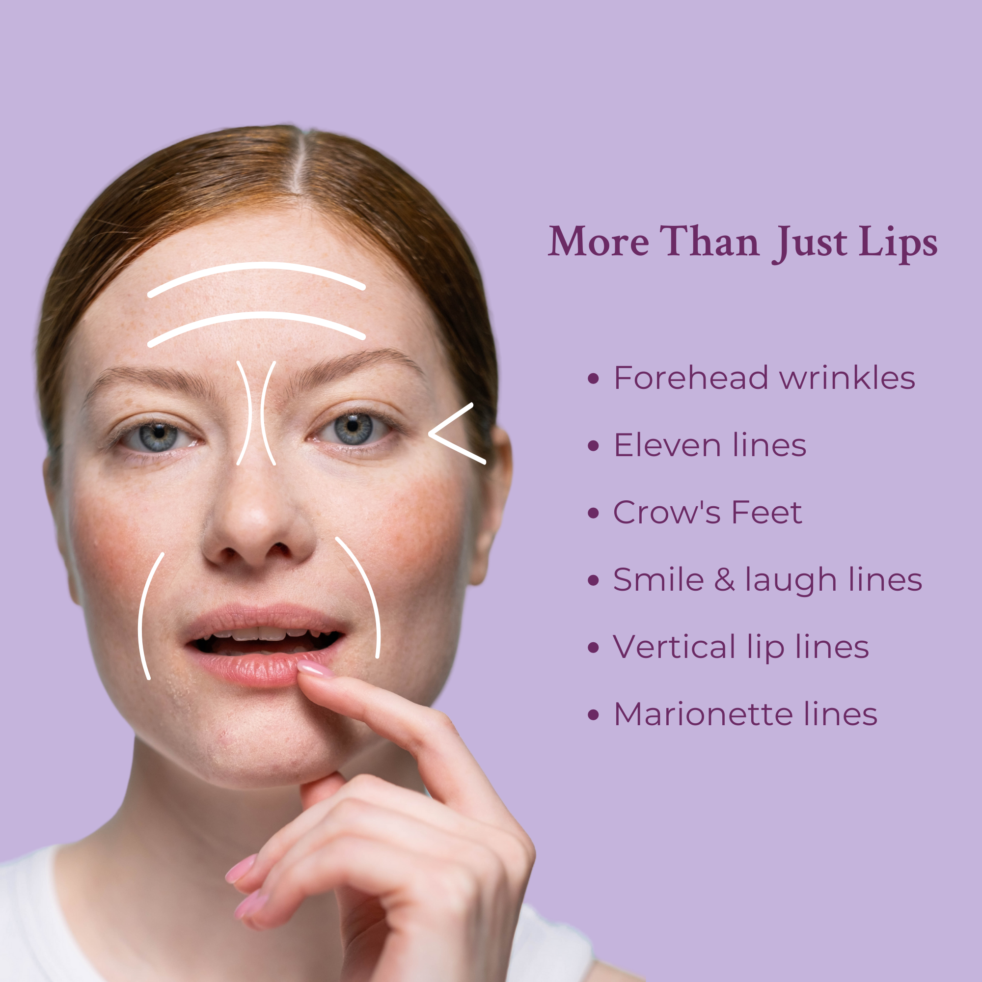 Ageless Lip & Line Filler